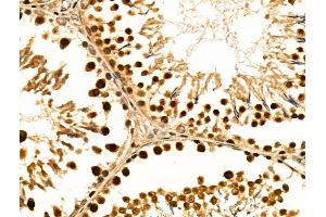 ABIN6258843 and ABIN6274212 at 1/100 staining Rat testis tissue by IHC-P.