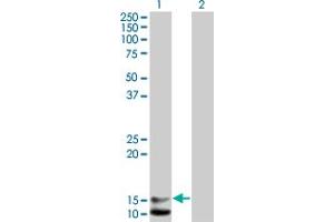 Western Blot analysis of NPPB expression in transfected 293T cell line by NPPB monoclonal antibody (M01), clone 2D11. (NPPB antibody  (AA 1-134))