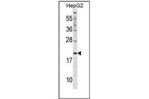 Western blot analysis of Cytoglobin (N-term) in HepG2 cell line lysates (35ug/lane). (CYGB antibody  (N-Term))