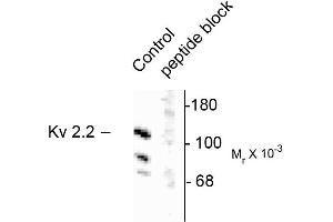 Western blots of rat brain homogenate showing specific immunolabeling of the ~125k voltage-gated potassium channel, Kv2. (Kv2.2 antibody)