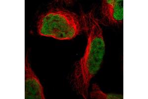 Immunofluorescent staining of human cell line U-2 OS shows localization to nucleoplasm.