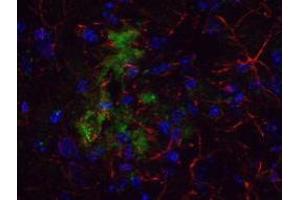 Immunofluorescence (IF) image for anti-Amyloid beta (Abeta) (N-Term) antibody (ABIN95037)