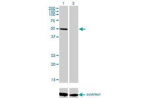 Western blot analysis of ZNF277 over-expressed 293 cell line, cotransfected with ZNF277 Validated Chimera RNAi (Lane 2) or non-transfected control (Lane 1). (ZNF277 antibody  (AA 1-278))
