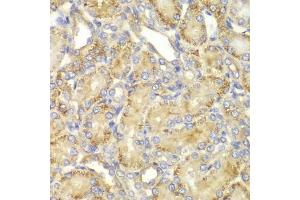 Immunohistochemistry of paraffin-embedded rat kidney using PP2A-B55α/PR55α/PPP2R2A antibody (ABIN3023153, ABIN3023154, ABIN3023155 and ABIN6219415) at dilution of 1:100 (40x lens). (PPP2R2A antibody  (AA 1-447))