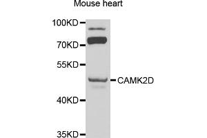 Western blot analysis of extracts of mouse heart, using CAMK2D antibody (ABIN1871415) at 1:1000 dilution.