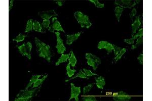 Immunofluorescence of monoclonal antibody to HFE on HeLa cell. (HFE antibody  (AA 115-205))