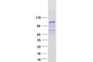 Validation with Western Blot