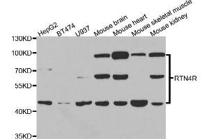 Western blot analysis of extracts of various cell lines, using RTN4R antibody (ABIN5973458) at 1/1000 dilution. (RTN4R antibody)