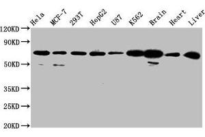 Western Blot Positive WB detected in: Hela whole cell lysate, MCF-7 whole cell lysate, 293T whole cell lysate, HepG2 whole cell lysate, U87 whole cell lysate, K562 whole cell lysate, Rat brain tissue, Mouse heart tissue, Mouse liver tissue All lanes: SLCO2A1 antibody at 2. (SLCO2A1 antibody  (AA 416-518))