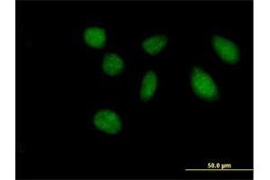 Immunofluorescence of purified MaxPab antibody to FAM47B on HeLa cell. (FAM47B antibody  (AA 1-645))