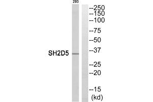 Western blot analysis of extracts from 293 cells, using SH2D5 antibody. (SH2D5 antibody  (C-Term))