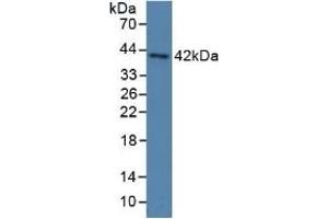 Detection of PON3 in Human Serum using Polyclonal Antibody to Paraoxonase 3 (PON3)