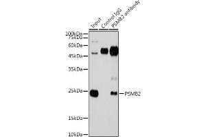 Immunoprecipitation analysis of 300 μg extracts of HeLa cells using 3 μg PSMB2 antibody (ABIN6129442, ABIN6146314, ABIN6146316 and ABIN6221150).