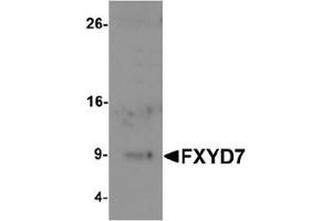Western blot analysis of FXYD7 in human lung tissue lysate with FXYD7 antibody at 1 ug/mL.