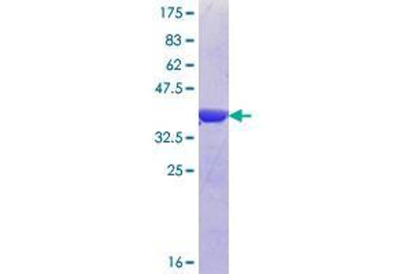 U2AF2 Protein (AA 141-240) (GST tag)