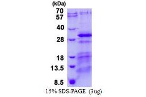 Image no. 1 for Charged Multivesicular Body Protein 5 (CHMP5) protein (His tag) (ABIN6387040) (CHMP5 Protein (His tag))