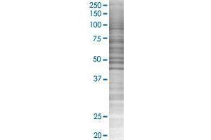 SLC40A1 transfected lysate. (SLC40A1 293T Cell Transient Overexpression Lysate(Denatured))