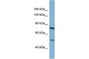 Host:  Rabbit  Target Name:  GALNT5  Sample Type:  COLO205 Whole Cell lysates  Antibody Dilution:  1.