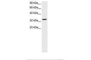 Image no. 3 for anti-SMAD, Mothers Against DPP Homolog 6 (SMAD6) (AA 137-182) antibody (ABIN202662)
