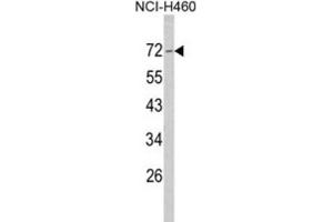 Western Blotting (WB) image for anti-Neurofibromin 2 (NF2) antibody (ABIN3002797)