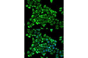 Immunofluorescence (IF) image for anti-Cytidine Deaminase (CDA) antibody (ABIN1871668) (CDA antibody)