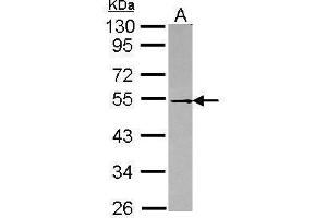 WB Image Sample (30 ug of whole cell lysate) A: Raji 10% SDS PAGE antibody diluted at 1:1000 (DOK1 antibody)