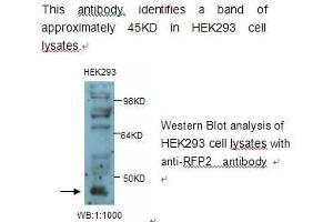 Image no. 1 for anti-Tripartite Motif Containing 13 (TRIM13) antibody (ABIN790828) (TRIM13 antibody)