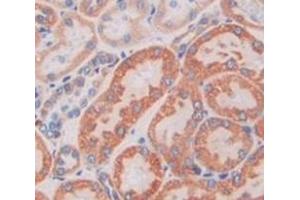 #VALUE! (M6PR antibody  (AA 27-185))