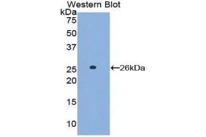 Western blot analysis of the recombinant protein. (LAT antibody  (AA 30-237))