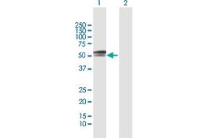 Western Blot analysis of PAX3 expression in transfected 293T cell line by PAX3 MaxPab polyclonal antibody. (Paired Box 3 antibody  (AA 1-484))