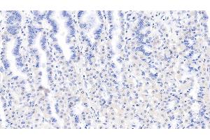 Detection of LSR in Human Stomach Tissue using Monoclonal Antibody to Lipolysis Stimulated Lipoprotein Receptor (LSR) (LSR antibody  (AA 335-589))