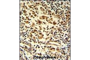 Formalin-fixed and paraffin-embedded human lymph reacted with HMHA1 Antibody (Center), which was peroxidase-conjugated to the secondary antibody, followed by DAB staining. (HMHA1 antibody  (AA 877-903))