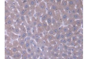DAB staining on IHC-P; Samples: Mouse Liver Tissue (Acyl-CoA Dehydrogenase, C-4 To C-12 Straight Chain (ACADM) (AA 131-421) antibody)