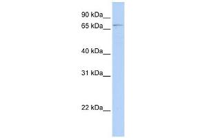 GLMN antibody used at 1 ug/ml to detect target protein. (GLMN antibody  (N-Term))