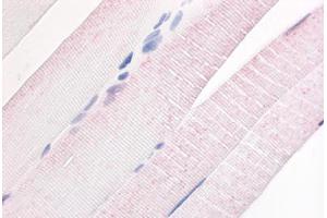 Human Skeletal Muscle (formalin-fixed, paraffin-embedded) stained with PDE7A antibody ABIN213530 at 20 ug/ml followed by biotinylated goat anti-rabbit IgG secondary antibody ABIN481713, alkaline phosphatase-streptavidin and chromogen. (PDE7A antibody  (N-Term))