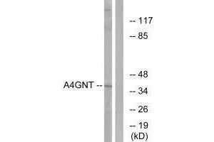 Western blot analysis of extracts from K562 cells, using A4GNT antibody. (A4GNT antibody)