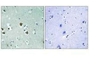 Immunohistochemistry analysis of paraffin-embedded human brain tissue using CRMP-2 (Ab-509) antibody. (DPYSL2 antibody  (Thr509))