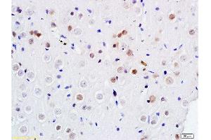 Formalin-fixed and paraffin embedded rat brain labeled with Anti DENTT Polyclonal Antibody, Unconjugated  at 1:200 followed by conjugation to the secondary antibody and DAB staining