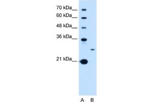 Western Blotting (WB) image for anti-Tetraspanin 15 (TSPAN15) antibody (ABIN2463029) (Tetraspanin 15 antibody)