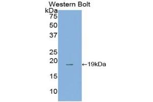 WB of Protein Standard: different control antibodies against Highly purified E.