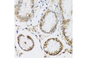 Immunohistochemistry of paraffin-embedded human stomach using ATP1A1 antibody (ABIN5970238) at dilution of 1/100 (40x lens). (ATP1A1 antibody)