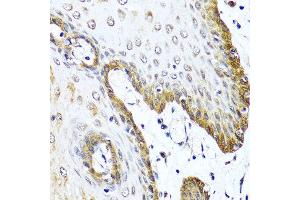 Immunohistochemistry of paraffin-embedded human esophagus using VIP antibody at dilution of 1:100 (40x lens).