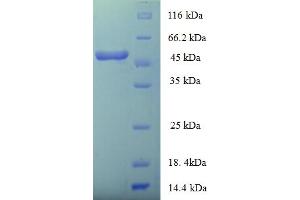 SDS-PAGE (SDS) image for HLA Class I Histocompatibility Antigen, alpha Chain E (HLA-E) (AA 22-305) protein (His-SUMO Tag) (ABIN5710770)