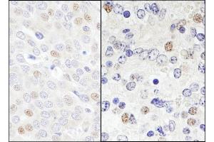 Immunohistochemistry (IHC) image for anti-DEAD (Asp-Glu-Ala-Asp) Box Polypeptide 46 (DDX46) (AA 300-350) antibody (ABIN7454388)
