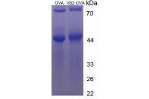 Image no. 2 for Vitamin B2 (Riboflavin) protein (Ovalbumin) (ABIN1880307) (Vitamin B2 Protein (Ovalbumin))