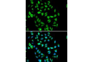 Immunofluorescence analysis of U2OS cells using STAMBP antibody (ABIN5974250).