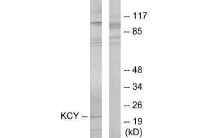 Western blot analysis of extracts from HeLa cells, using KCY antibody. (KCY (N-Term) antibody)