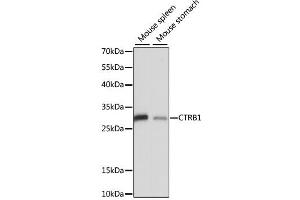 Western blot analysis of extracts of various cell lines, using CTRB1 antibody.