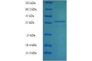 SDS-PAGE (SDS) image for PDZ and LIM Domain 7 (Enigma) (PDLIM7) (AA 185-386) protein (His-SUMO Tag) (ABIN5710742)