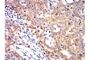 Immunohistochemistry (IHC) image for anti-Keratin 10 (KRT10) (AA 345-454) antibody (ABIN5888939) (Keratin 10 antibody  (AA 345-454))